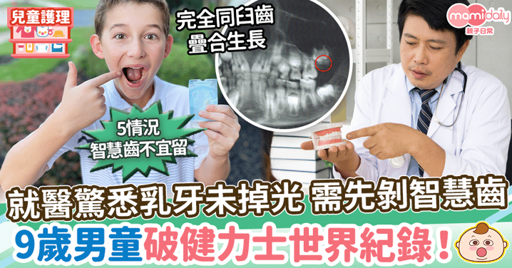 【牙齒健康】乳牙未掉光就剝智慧齒　9歲男童破健力士世界紀錄！ 5情況智慧齒不宜留