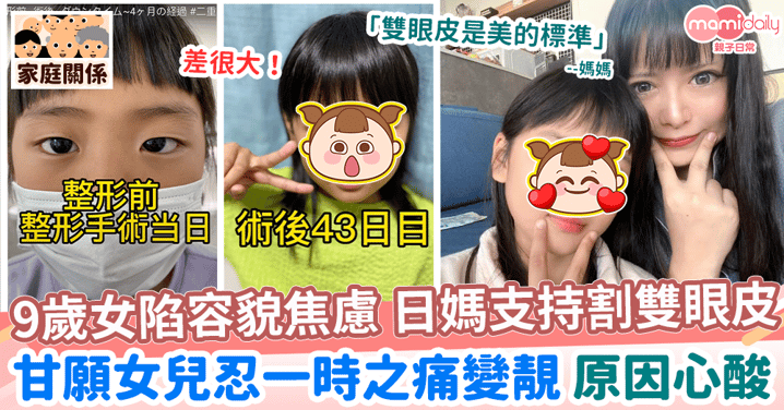 【容貌焦慮】日本媽媽帶9歲女割雙眼皮　甘願女兒忍耐一時痛苦變靚 心酸原因曝光