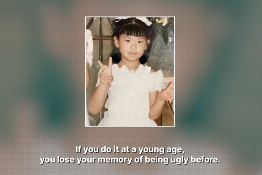 Rucchi小時候因為單眼皮遭受許多委屈。