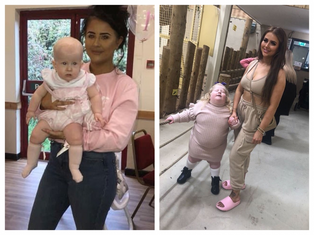 Harlow剛出生時比起正常嬰兒體積要小,然而卻在6個月後確診「小胖威利症」。