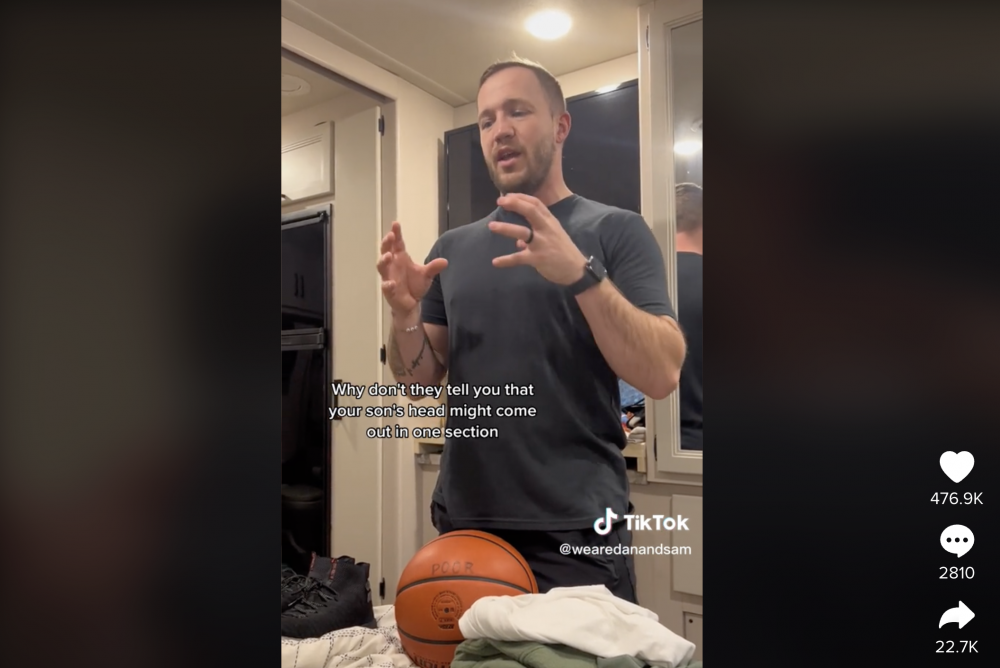 丈夫對於BB頭部變形感到驚訝不已。