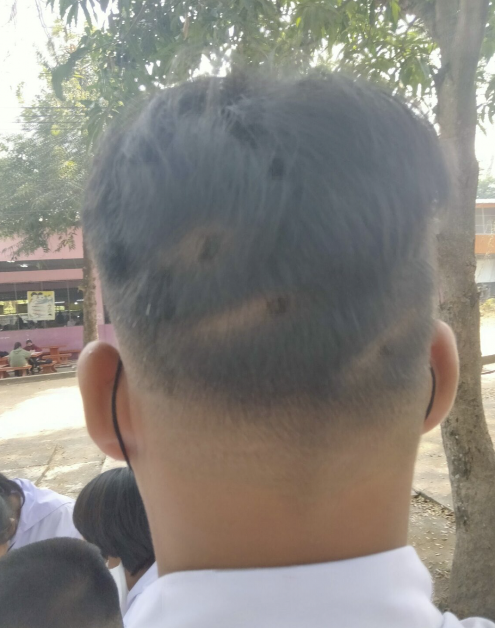 學生的頭髮東缺一塊西缺一塊。