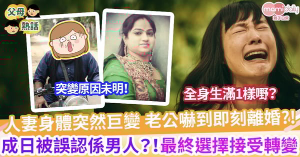 【過多體毛】老公嚇到即刻離婚?! 全因老婆婚後突然全身係咁生毛 更一度憂鬱