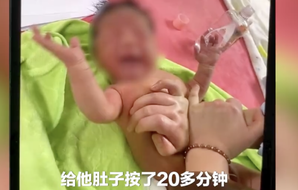 結果護士大力按壓BB腹部,導致腸壞死。