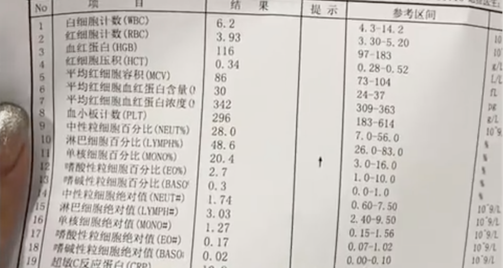 嬰兒疑似感染「親吻病」。