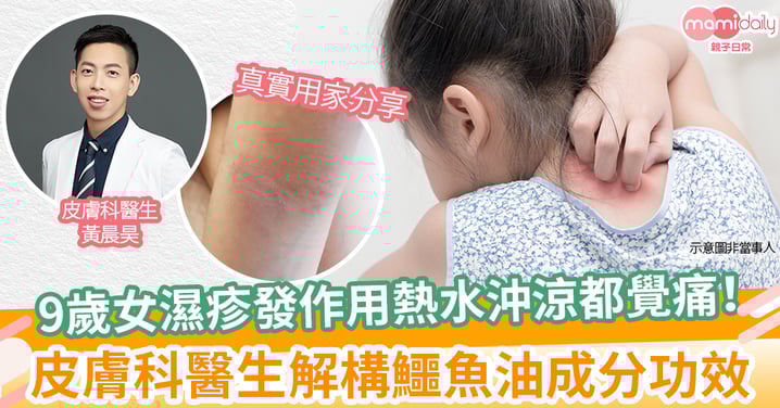 9歲女濕疹發作用熱水沖涼都覺痛! 皮膚科醫生解構鱷魚油成分功效 (附港媽真實用後感)