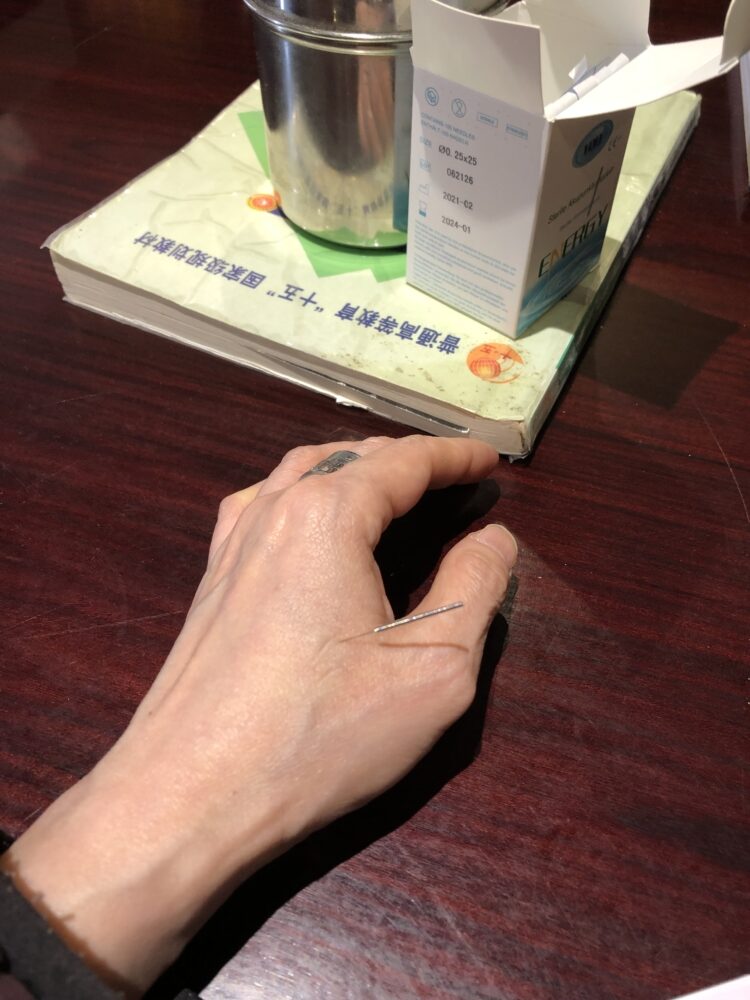 幫自己落的第一針，在合谷穴