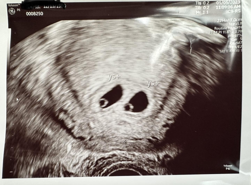 今年母親節，便當夫人宣布懷雙胞胎。