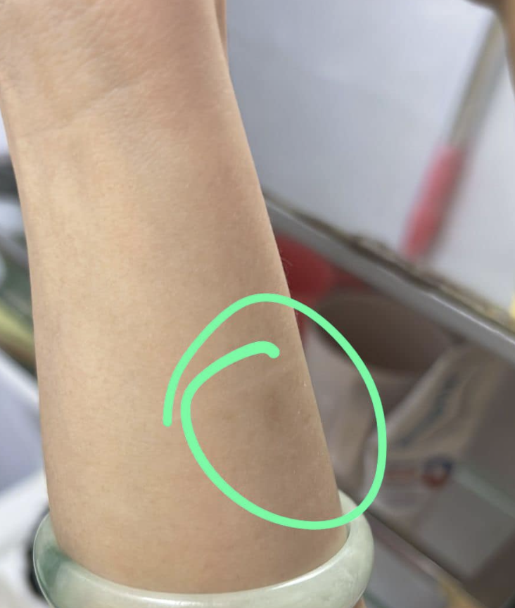 拉扯下，事主被撞瘀及刮損手。