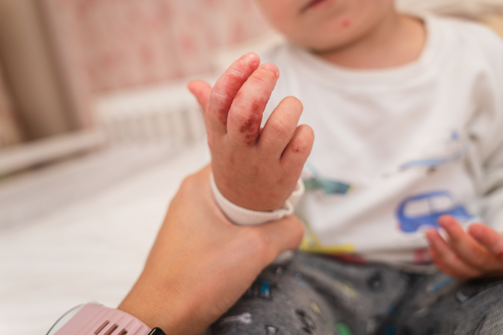 有網民表示，同事得知孩子感染腸病毒，卻還是要帶他們出遊。