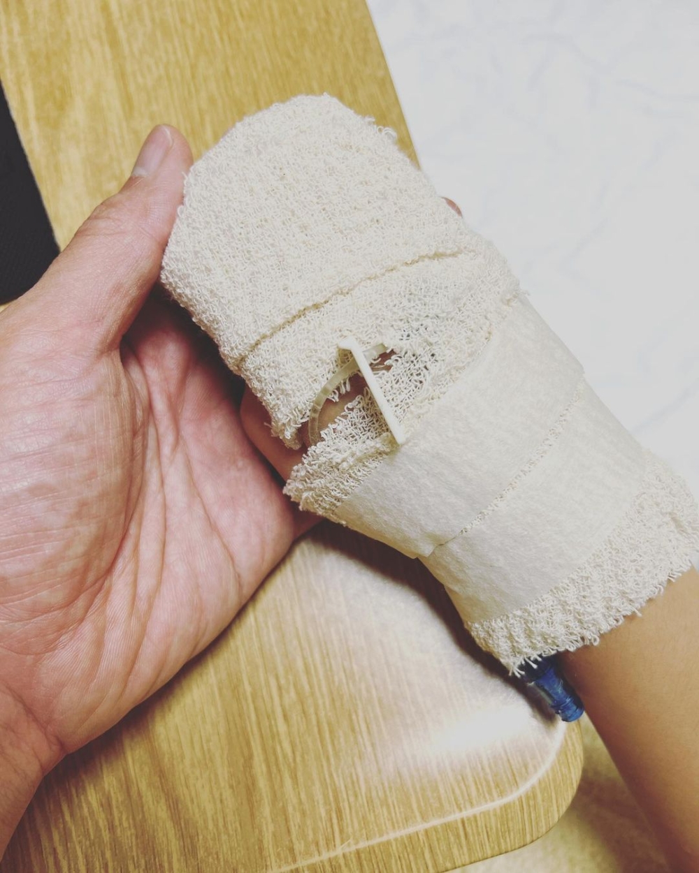 峰峰發高燒，令父母十分擔心