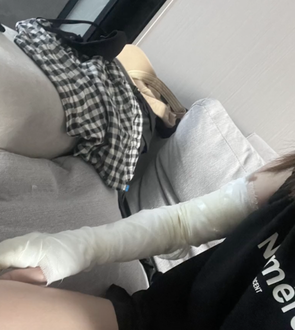 傷勢幾乎覆蓋整個手臂。