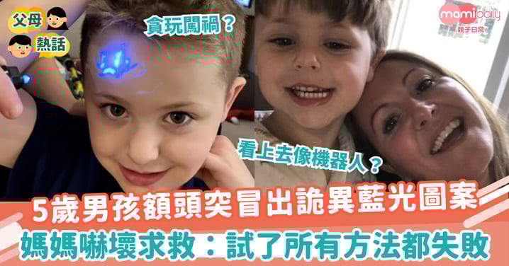【古靈精怪】5歲男孩額頭突冒出詭異藍光圖案 媽媽嚇壞求救:試了所有方法都失敗