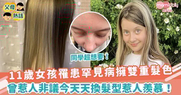 【白毛症】11歲女孩罹患罕見病擁雙重髮色 曾惹人非議今天天換髮型惹人羨慕!