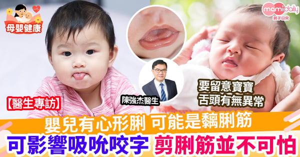 【兒童健康】嬰兒心形脷 可能是黐脷筋   剪脷筋並不如想像般可怕