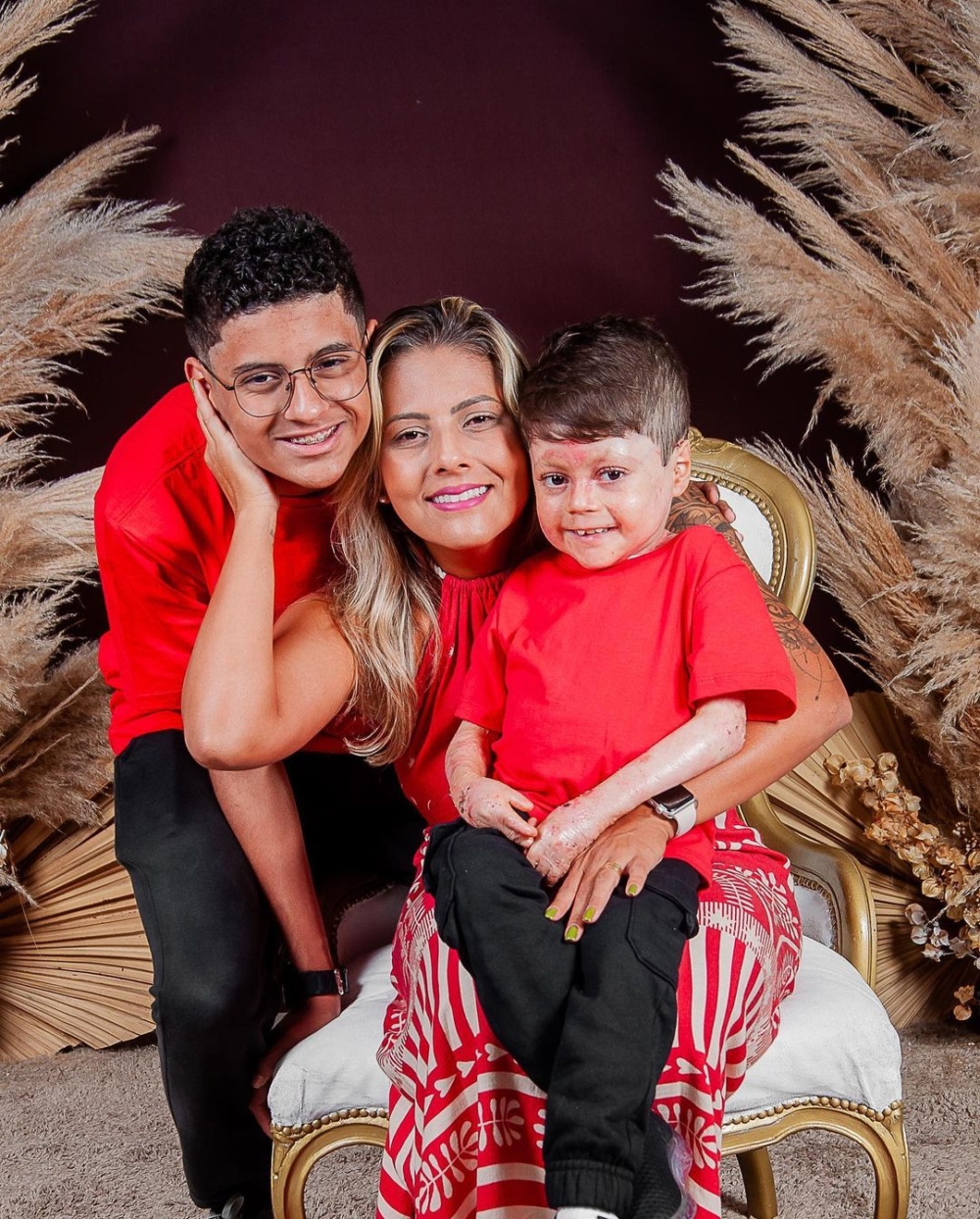 Guilherme罹患罕見遺傳病,皮膚容易出血潰爛。