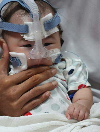 經測試後，醫生發現BB患有脊髓性肌萎縮症。