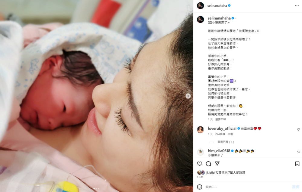 藝人任家萱（Selina）公布兒子「小腰果」已經出世，因肺積水要插管，在保溫箱住了幾天
