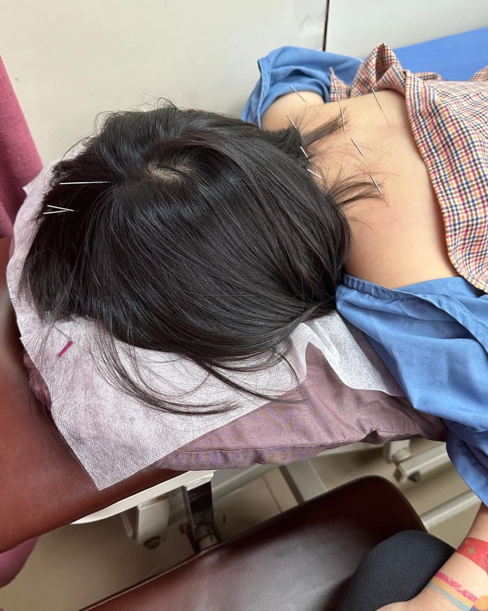 Lucy肩背和頭頂共㓤約12針。