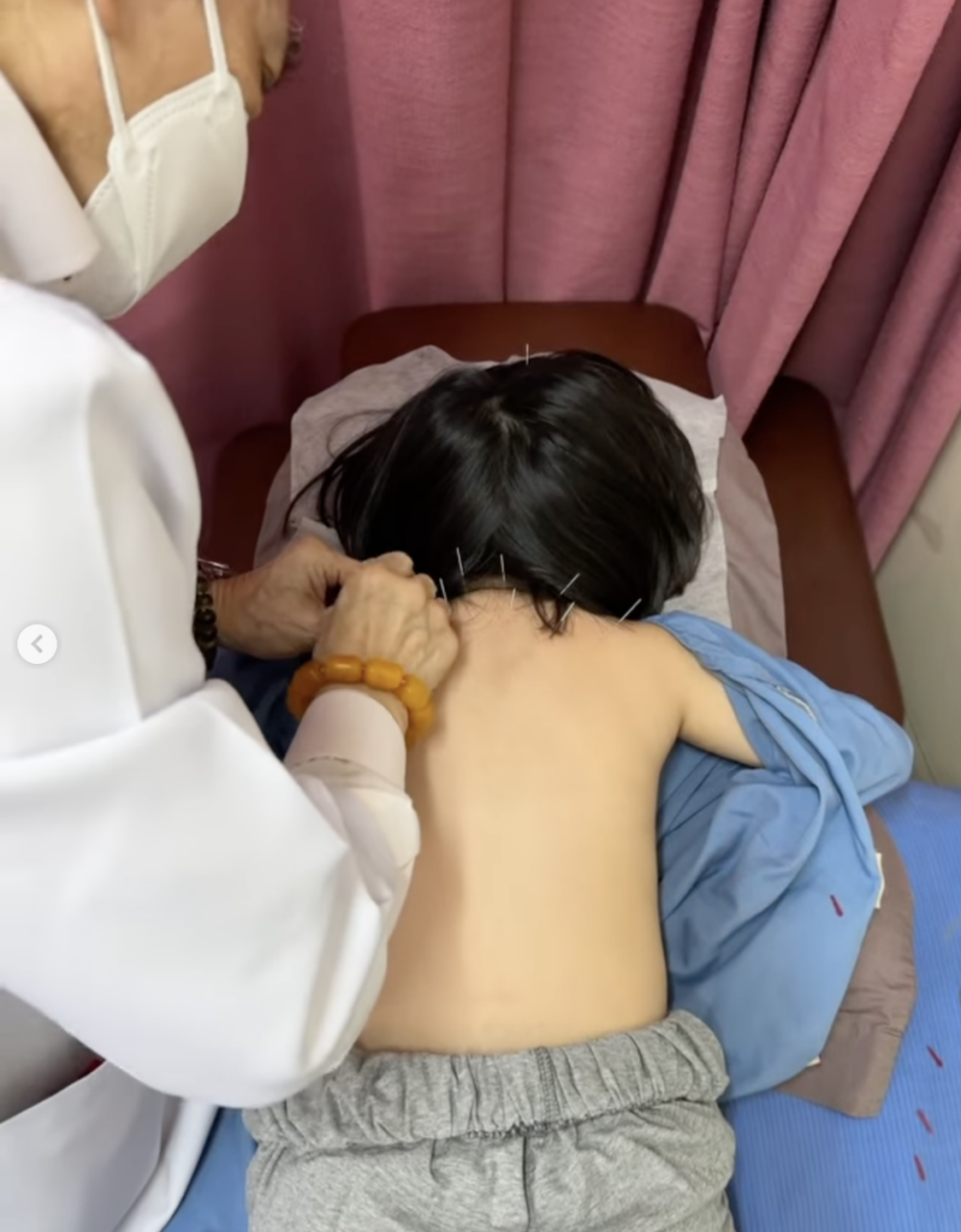 久咳不癒的Lucy需要接受針灸治療。