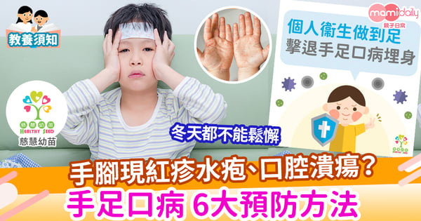 【健康】個人衞生做到足 擊退手足口病埋身