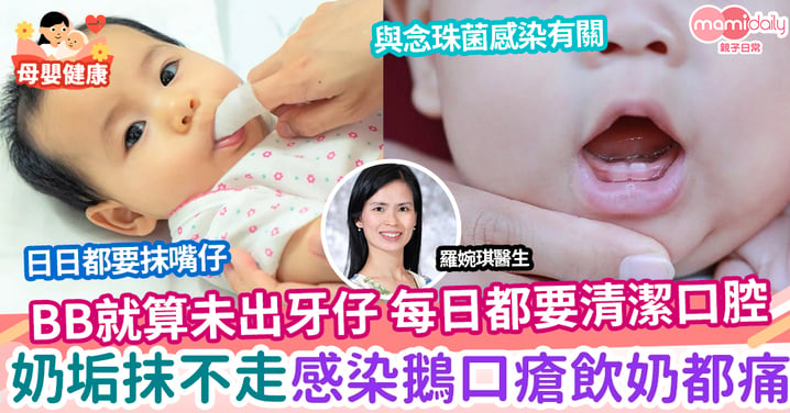 【健康】寶寶口中奶垢抹不走？或是口腔清潔不足致鵝口瘡