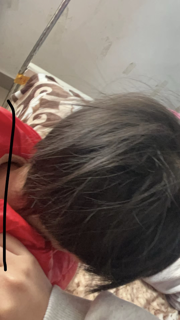 嫲嫲僅一天沒有幫孫女紥頭髮,就被爺爺剪短了頭髮。