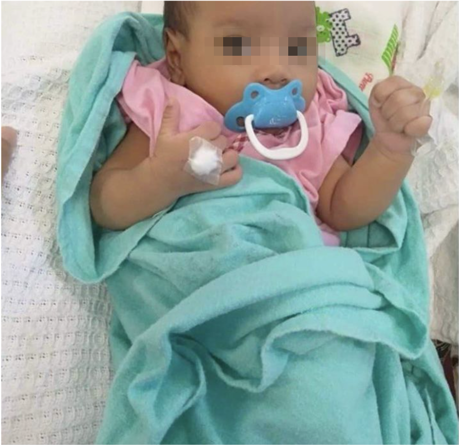馬來西亞一名女嬰遭奶奶餵水，出現腸腫脹。