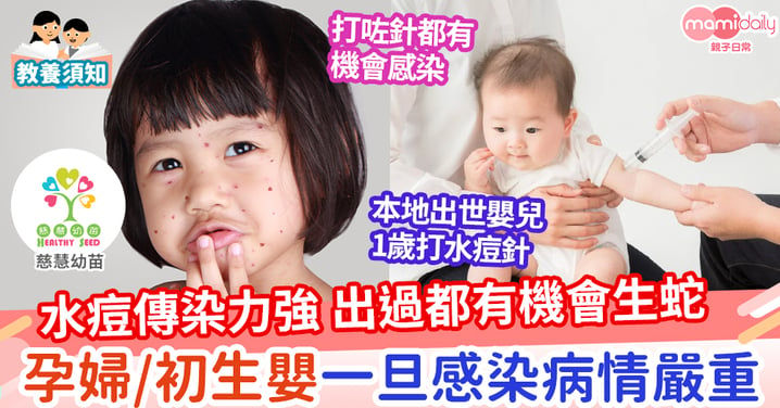 【親子健康】水痘傳染性高    兒童接種疫苗增免疫能力