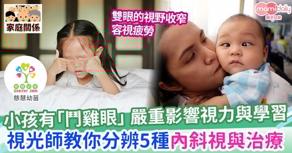【親子健康】小孩有「鬥雞眼」,怎麼辦?