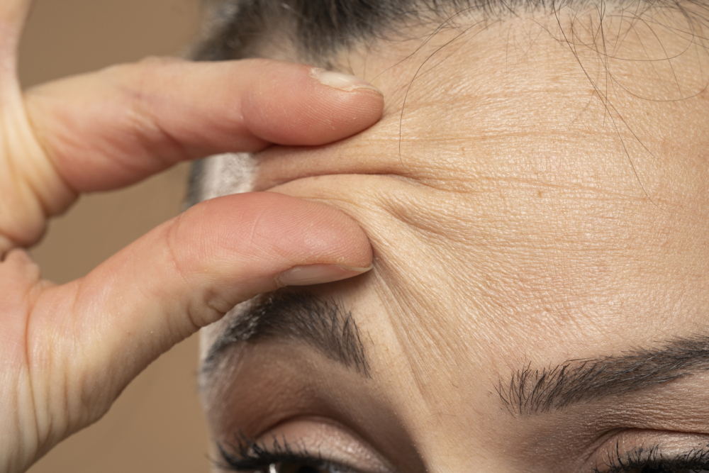 額頭皺紋一般分為兩種類型：動態紋和靜態紋，形成原因不同，淡化和保養方法也不同。