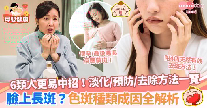 臉上突然長斑?6類人更易中招!色斑種類成因、預防淡化去除方法全解析!