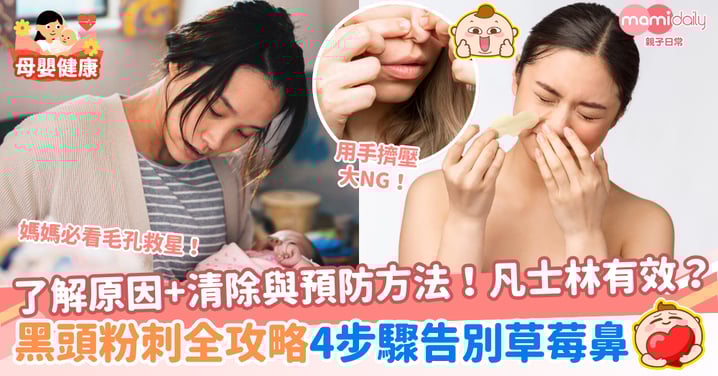 黑頭粉刺全攻略:原因、清除與預防方法!4步驟告別草莓鼻,凡士林有效?媽媽必看毛孔救星!