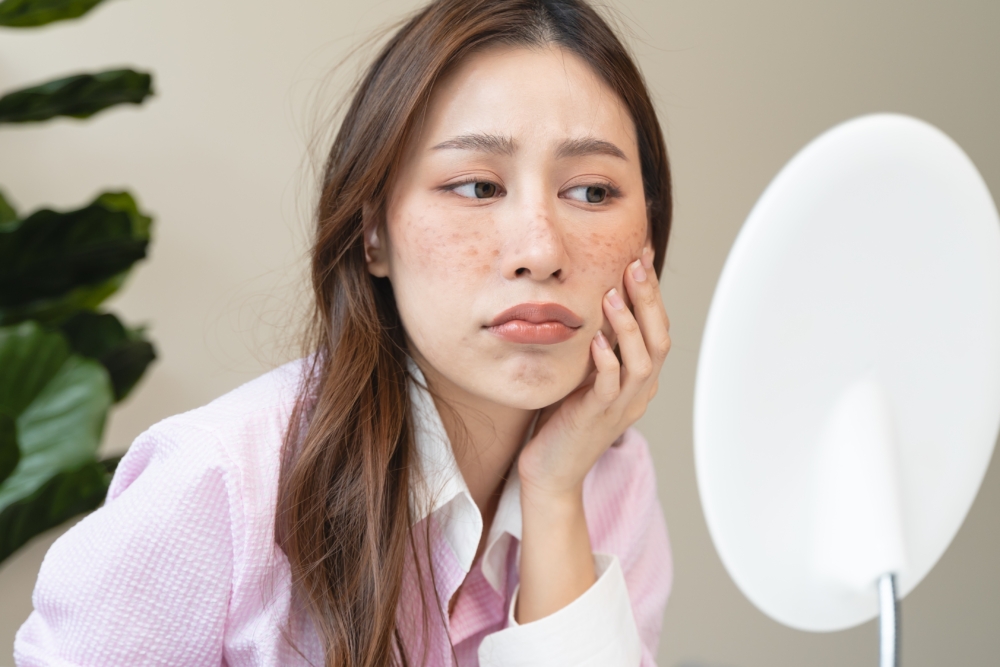 如果是肝斑或老年斑等屬於深層色斑，通常只能減淡至不明顯，難以完全消失。