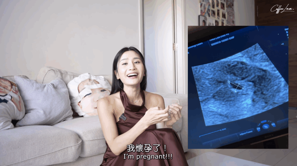 Coffee分享喜訊同時公布BB可能有染色體問題
