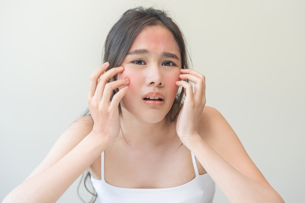 敏感肌典型的五大特徵包括：皮膚容易泛紅、灼熱刺痛，常有乾燥脫皮、粗糙緊繃及痕癢感