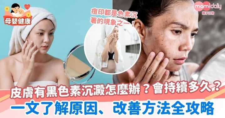 【黑色素沉澱】黑色素沉澱怎麼辦?持續多久?一文了解原因、改善方法全攻略