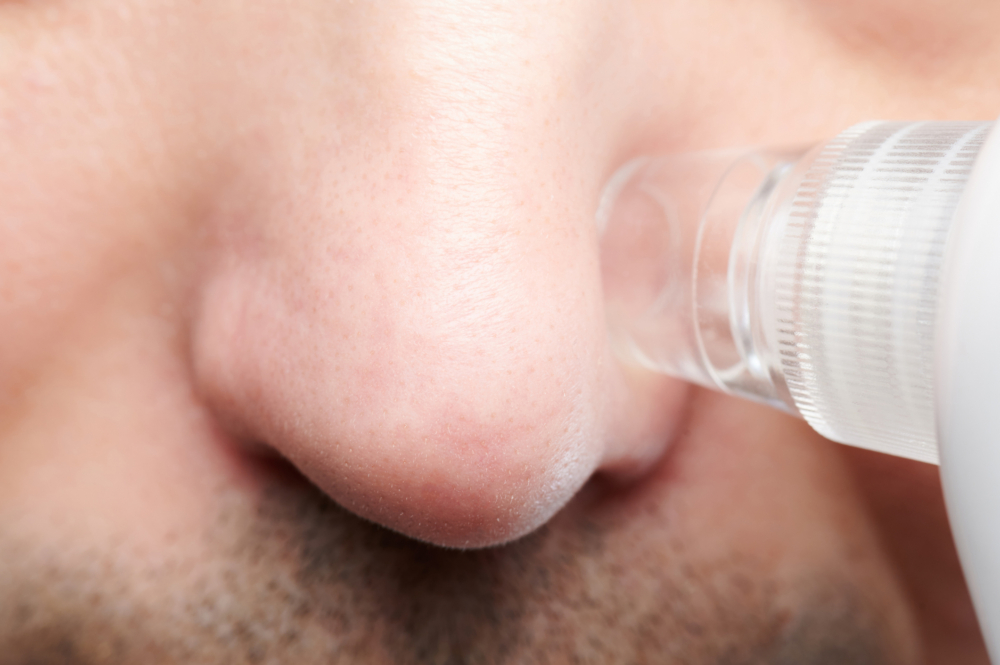 清除黑頭粉刺方法:吸黑頭儀器。