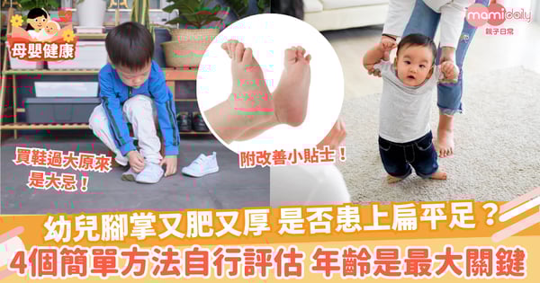 【兒童疾病】幼兒腳掌又肥又厚 是否患上扁平足? 4個簡單方法自行評估 年齡是最大關鍵