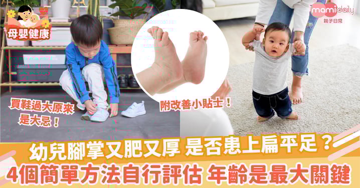 【兒童疾病】幼兒腳掌又肥又厚 是否患上扁平足? 4個簡單方法自行評估 年齡是最大關鍵