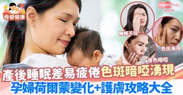 【產後護理】睡眠差易攰皮膚差?孕產婦荷爾蒙變化+護膚攻略全解讀!