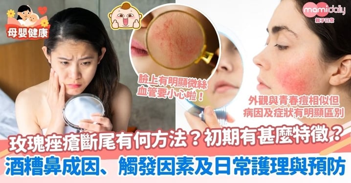 【玫瑰痤瘡】玫瑰痤瘡斷尾有何方法?初期有甚麼特徵?一文了解酒糟鼻成因、觸發因素及日常護理與預防