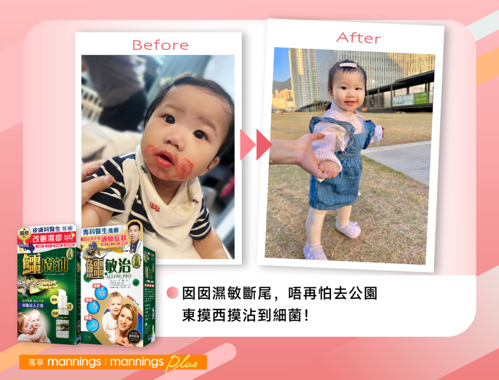 短短3天，我就發現囡囡皮膚的紅腫明顯減輕了，關節位的濕敏位置也有「收水」的好轉！