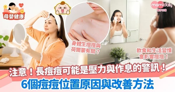 【痘痘位置】孕期或會因這個問題導致痘痘！不同痘痘位置原因與改善＋荷爾蒙、生活、飲食習慣對痘痘的影響