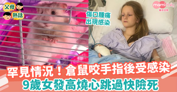 【寵物】罕見情況！倉鼠咬手指後受感染  9歲女發高燒心跳過快險死