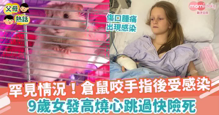 【寵物】罕見情況!倉鼠咬手指後受感染 9歲女發高燒心跳過快險死