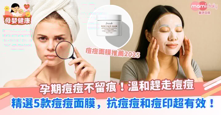 孕期痘痘不留痕!精選5款痘痘面膜,抗痘痘和痘印超有效,溫和趕走痘痘