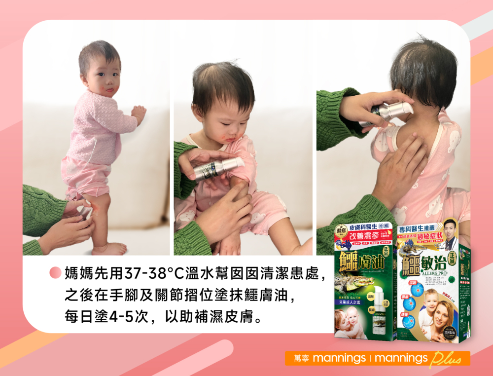 Candy媽媽採納了「內服外用，雙管齊下」的方式。