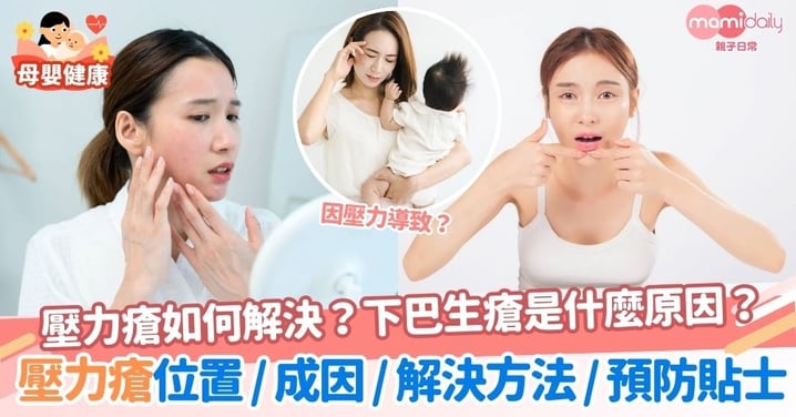 【壓力瘡】壓力瘡如何解決？下巴生瘡是什麼原因？一文揭壓力瘡位置＋成因＋解決方法＋預防貼士