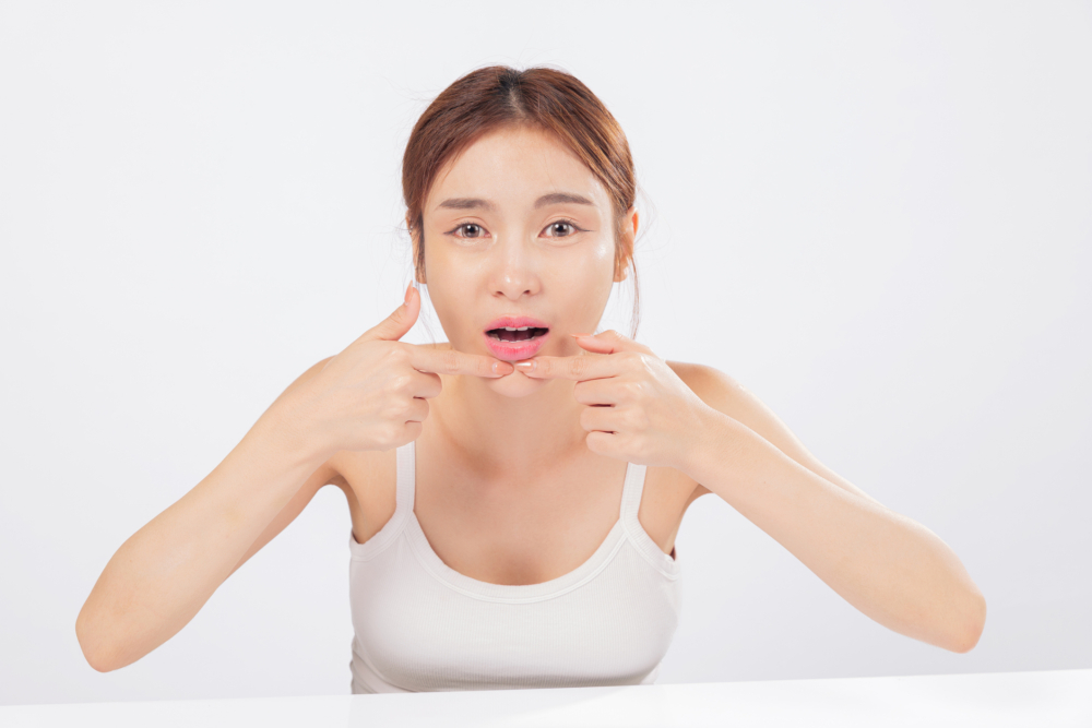 保持雙手清潔，勿觸碰或擠壓痘痘，減少感染與疤痕風險。